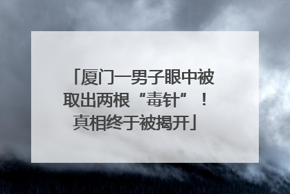厦门一男子眼中被取出两根“毒针”！真相终于被揭开